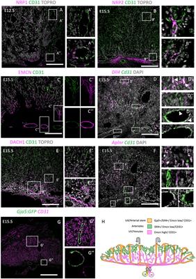 Analysis of Placental Arteriovenous Formation Reveals New Insights Into Embryos With Congenital Heart Defects